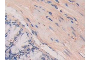 Detection of LAMa4 in Mouse Colon Tissue using Polyclonal Antibody to Laminin Alpha 4 (LAMa4)