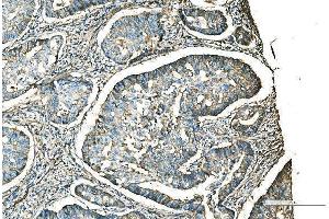 IHC analysis of CD9 using anti-CD9 antibody (ABIN7600001). (CD9 anticorps  (AA 139-192))