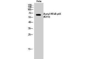 Western Blotting (WB) image for anti-Nuclear Factor-kB p65 (NFkBP65) (acLys310) antibody (ABIN3181877) (NF-kB p65 anticorps  (acLys310))