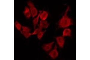 ABIN6267494 staining Hela by IF/ICC. (SREBF1 anticorps  (pSer439))