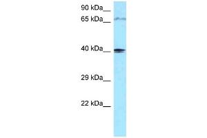 WB Suggested Anti-PIP5KL1 Antibody Titration: 1.