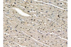 ABIN7095385 and ABIN7099442 at 1/100 staining rat heart tissue by IHC-P.