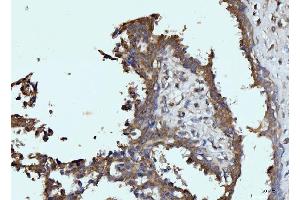 IHC analysis of Glutaminase/GLS using anti-Glutaminase/GLS antibody (ABIN7601601). (Glutaminase anticorps  (AA 396-654))