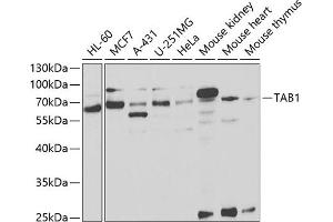 Western blot analysis of extracts of various cell lines, using T antibody (ABIN6131955, ABIN6148795, ABIN6148796 and ABIN6221421) at 1:1000 dilution.