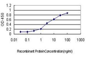 Detection limit for recombinant GST tagged GCK is approximately 0. (GCK anticorps  (AA 356-465))