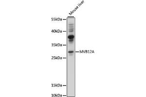 Western blot analysis of extracts of mouse liver, using MVB12A antibody (ABIN7267104) at 1000 dilution. (FAM125A anticorps  (AA 1-273))