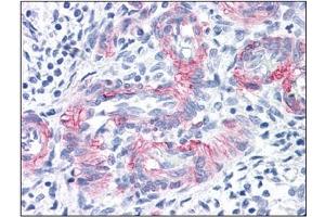 Immunohistochemistry (IHC) image for anti-Melanoma Cell Adhesion Molecule (MCAM) antibody (ABIN614548) (MCAM anticorps)