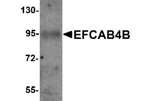 Western Blotting (WB) image for anti-EF-Hand Calcium Binding Domain 4B (EFCAB4B) (C-Term) antibody (ABIN1030378) (EFCAB4B anticorps  (C-Term))
