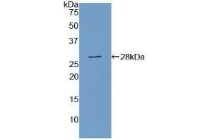 Detection of Recombinant CSE, Human using Polyclonal Antibody to Cystathionine (CTH)