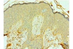 Immunohistochemistry of paraffin-embedded human skin tissue using ABIN7153122 at dilution of 1:100 (FOSL1 anticorps  (AA 1-100))