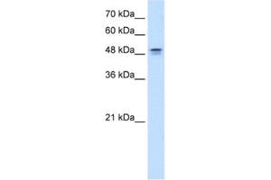 Western Blotting (WB) image for anti-Dihydroorotate Dehydrogenase (DHODH) antibody (ABIN2462489) (DHODH anticorps)