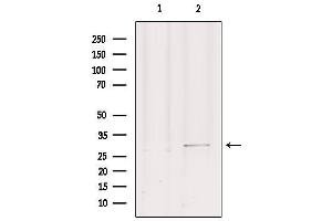 Western blot analysis of extracts from mouse brain, using GEMIN2 Antibody.