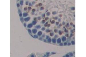 Used in DAB staining on fromalin fixed paraffin- embedded Kidney tissue (Nanog anticorps  (AA 1-305))