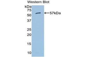 Western Blotting (WB) image for anti-Aldehyde Dehydrogenase 7 Family, Member A1 (ALDH7A1) (AA 28-539) antibody (ABIN1077761) (ALDH7A1 anticorps  (AA 28-539))