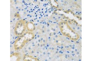 Immunohistochemistry of paraffin-embedded Rat kidney using PMPCB Polyclonal Antibody at dilution of 1:100 (40x lens). (PMPCB anticorps)