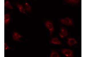 ABIN6274732 staining 293 by IF/ICC.