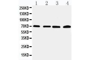 Anti-IRAK2 antibody, Western blotting Lane 1: 22RV Cell Lysate Lane 2: A549 Cell Lysate Lane 3: PANC Cell Lysate Lane 4: SMMC Cell Lysate (IRAK2 anticorps  (C-Term))