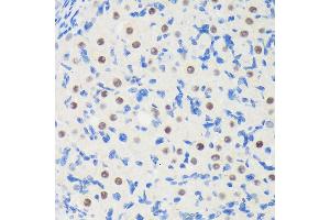 Immunohistochemistry of paraffin-embedded Rat ovary using LB Rabbit pAb (ABIN6131871, ABIN6143090, ABIN6143091 and ABIN6217142) at dilution of 1:100 (40x lens).