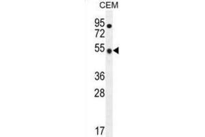 Western Blotting (WB) image for anti-TBC1 Domain Family, Member 13 (TBC1D13) antibody (ABIN2996418)