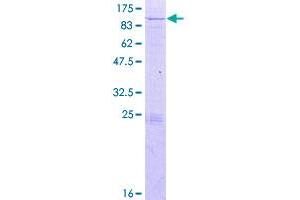 Image no. 1 for Kelch-Like 20 (KLHL20) (AA 1-609) protein (GST tag) (ABIN1308808)