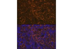 Immunofluorescence analysis of rat spleen using LSP1 Rabbit mAb (ABIN7268319) at dilution of 1:100 (40x lens). (LSP1 anticorps)