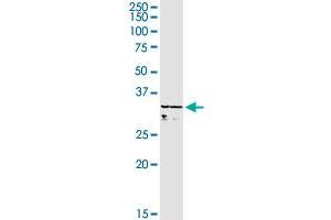 WBSCR22 MaxPab rabbit polyclonal antibody. (WBSCR22 anticorps  (AA 1-281))