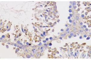 Immunohistochemistry of paraffin-embedded Mouse testis using Bcl-2 Polyclonal Antibody at dilution of 1:100 (40x lens). (Bcl-2 anticorps)