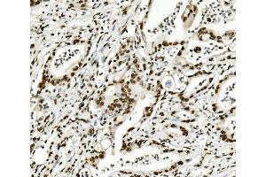 IHC analysis of KAP1/TRIM28 using anti-KAP1/TRIM28 antibody (ABIN7602310). (KAP1 anticorps  (AA 699-835))