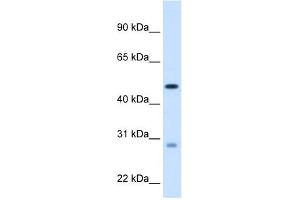 WB Suggested Anti-ECHS1 Antibody Titration:  1. (ECHS1 anticorps  (C-Term))