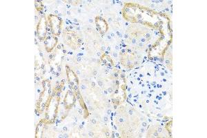 Immunohistochemistry of paraffin-embedded rat kidney using BSND antibody. (BSND anticorps  (AA 54-320))
