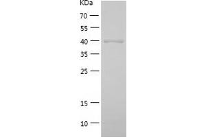 Western Blotting (WB) image for Alcohol Dehydrogenase 6 (Class V) (ADH6) (AA 1-375) protein (His tag) (ABIN7121769)