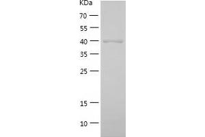 Western Blotting (WB) image for Alcohol Dehydrogenase 6 (Class V) (ADH6) (AA 1-375) protein (His tag) (ABIN7121769) (ADH6 Protein (AA 1-375) (His tag))