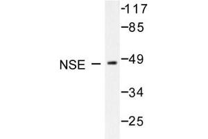 Image no. 1 for anti-Enolase 2 (Gamma, Neuronal) (ENO2) antibody (ABIN271752) (ENO2/NSE anticorps)