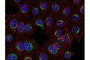 Immunocytochemistry analysis of Syk in human HeLa cell line using anti-Syk (SYK-01, green).
