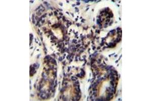 Immunohistochemistry analysis in formalin fixed and paraffin embedded human breast tissue reacted with AP52820PU-N, which was peroxidase conjugated to the secondary antibody and followed by DAB staining. (NBPF8 anticorps  (N-Term))