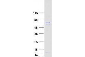 Validation with Western Blot