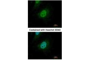 ICC/IF Image Immunofluorescence analysis of paraformaldehyde-fixed HeLa, using SMAD9, antibody at 1:500 dilution. (SMAD9 anticorps)