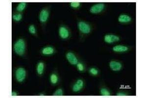 Immunostaining analysis in HeLa cells.