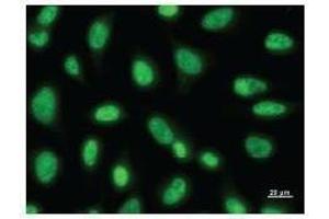 Immunostaining analysis in HeLa cells. (PAX6 anticorps)