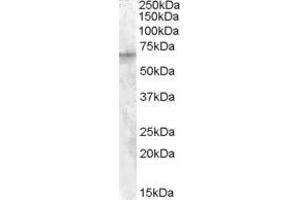 ABIN238651 (1µg/ml) staining of HepG2 cell lysate (35µg protein in RIPA buffer).