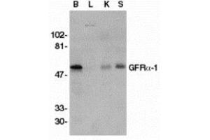 Western blot analysis of GFR alpha 1 in crude membrane fractions of human brain (B), liver (L), kidney (K), and spleen (S), respectively, with AP30361PU-N GFR alpha 1 antibody at 1/500 dilution.