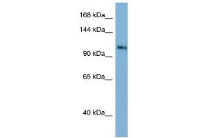 Host: Rabbit Target Name: TSC22D1 Antibody Dilution: 1. (TSC22D1 anticorps  (C-Term))
