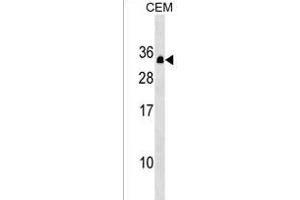 PDCD10 Antibody (Center) (ABIN1538712 and ABIN2849495) western blot analysis in CEM cell line lysates (35 μg/lane). (PDCD10 anticorps  (AA 96-124))