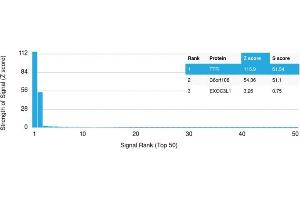 Analysis of Protein Array containing more than 19,000 full-length human proteins using Transthyretin (Prealbumin) Mouse Monoclonal Antibody (CPTC-TTR-1).