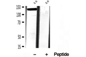 Western blot analysis of extracts of HL-60 cells, using TET2 antibody.