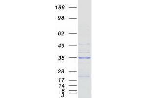 Validation with Western Blot