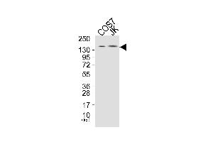 Western blot analysis of extracts from COS7 cells (Lane 1), and JK cells (Lane 2), using PLCG1 (Ab-771) Antibody. (Phospholipase C gamma 1 anticorps)