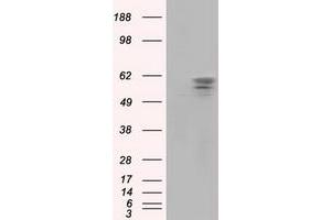 Image no. 2 for anti-Pantothenate Kinase 2 (PANK2) antibody (ABIN1500026)