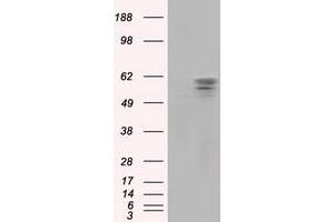 Image no. 2 for anti-Pantothenate Kinase 2 (PANK2) antibody (ABIN1500026) (PANK2 anticorps)