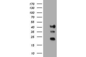 Image no. 1 for anti-Transmembrane Protein 173 (TMEM173) antibody (ABIN1501425) (STING/TMEM173 anticorps)